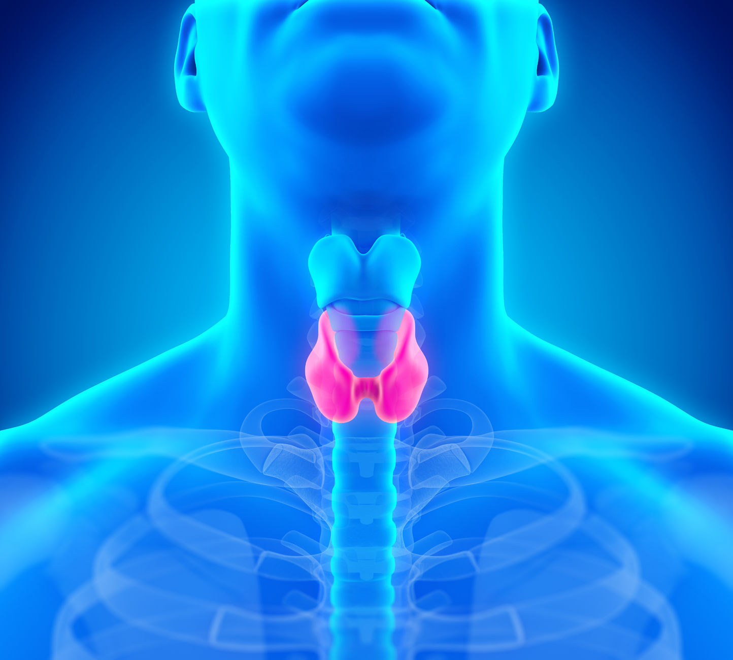 graves, graves disease, thyroid, the woodlands, theramineral, texas, houston, vitamins, supplements